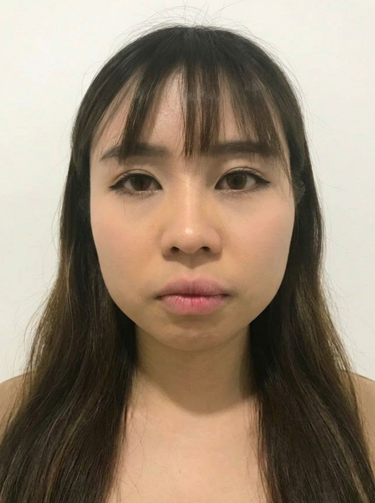 Agnes — before